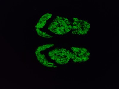 Glow in the Dark Flip Flops